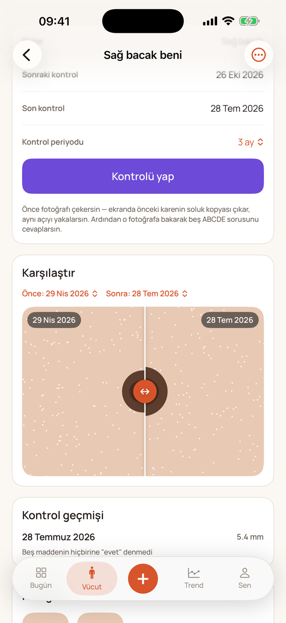 Ben karşılaştırma