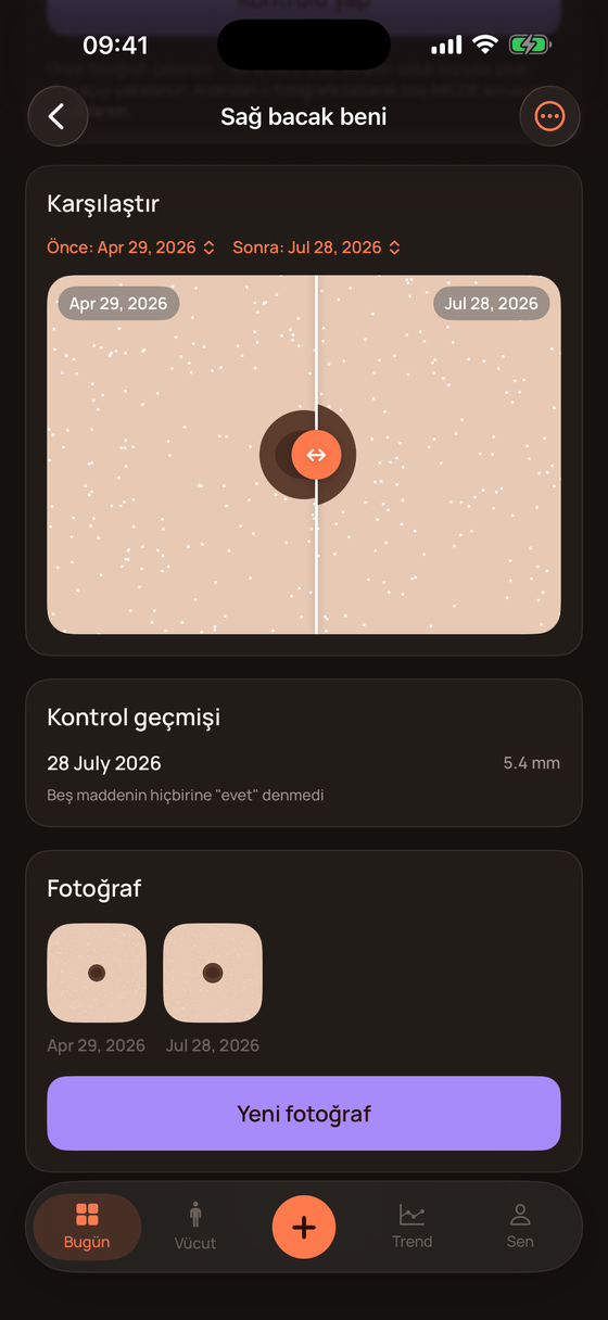 Koyu temada ben takibi
